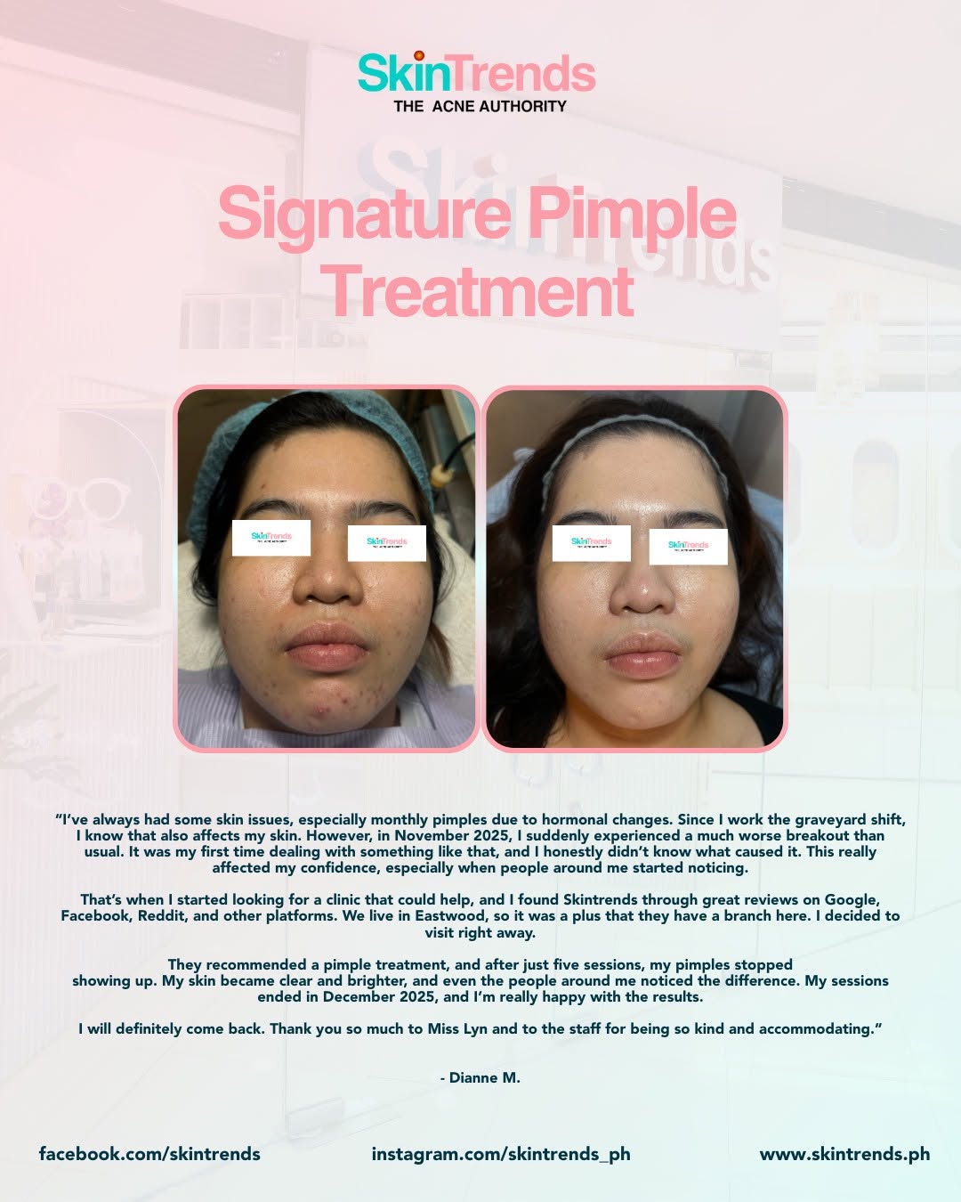 Skin Trends Signature Pimple Treatment before and after — patient Dianne M. shares: After just five sessions, my pimples stopped showing up. My skin became clear and brighter.